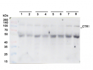 CTR1 | Constitutive triple response 1 in the group Antibodies Plant/Algal / Hormones / Biosynthesis/regulation at Agrisera AB (Antibodies for research) (AS16 3988)